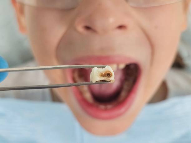 Best Weekend Emergency Dentist in Edinboro, PA